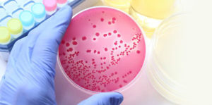 Food poisoning agar culture