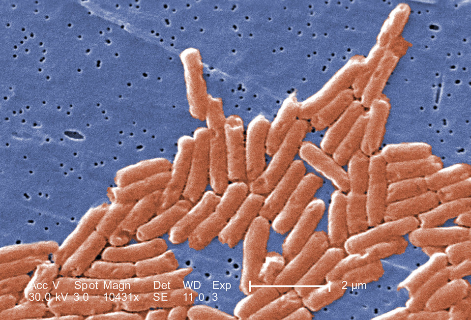 Salmonella bacteria heavily magnified