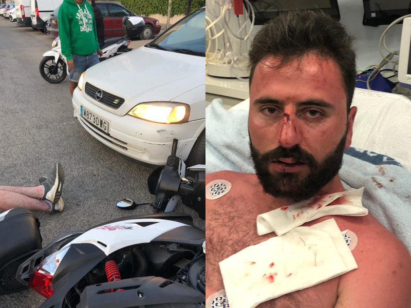 22 Year Old Motorcyclist Victim Receives £58,000 Compensation Payout After Holiday Nightmare in Ibiza