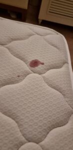 Blood stain from lacerations suffered in bed